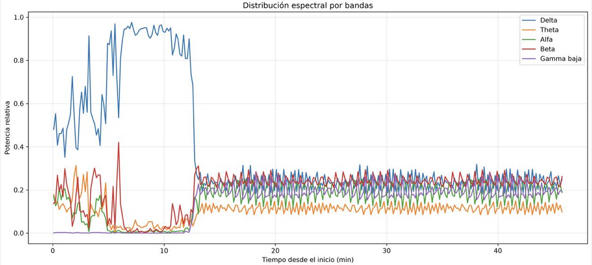 DiegoEscarraman's tweet photo. Nada como terminar la tarde con Python y un electroencefalograma (EEG) crudo.
#AventhoAnestesia #Aventho #SMMCE #SAML
Hoy analizamos un registro obtenido durante anestesia utilizando únicamente datos sin procesar del monitor. Lo interesante no fue buscar un índice “comercial”, sino observar cómo cambia la dinámica cerebral a lo largo del tiempo.
En un punto del registro aparece una transición muy marcada: disminuye el predominio de las ondas lentas (delta), la distribución de la potencia espectral se reorganiza entre todas las bandas de frecuencia, aumenta la entropía espectral (mayor complejidad de la señal) y cambia la correlación entre ambos hemisferios cerebrales.
¿Podría corresponder a la emersión anestésica? Aún no lo sabemos. Para responderlo habría que sincronizar el EEG con los eventos clínicos y armar el protocolo de investigación. Pero si, el EEG crudo parece contener mucha más información de la que normalmente utilizamos.
Quizá la emersión no sea un simple “despertar”, sino una transición dinámica entre diferentes estados cerebrales que todavía estamos aprendiendo a cuantificar.
Apenas estamos comenzando a explorar todo lo que puede esconderse en estas señales, los llamados “índice de complejidad cerebral”.