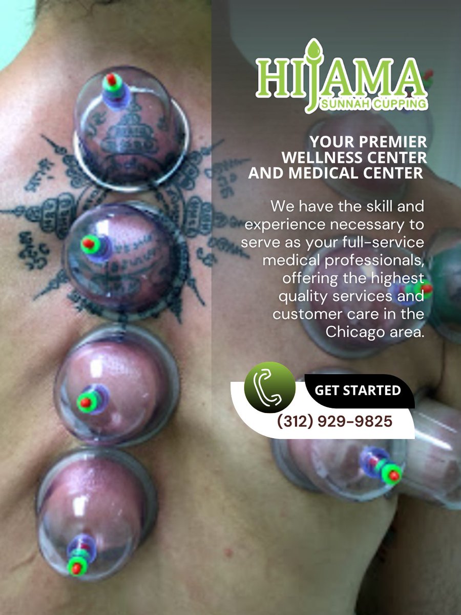 CuppingSunnah's tweet photo. We use cupping as a simple but powerful way to help the body release built-up stress. It's been trusted for generations for a reason. Reserve a visit to experience the natural relief firsthand. #Cupping #WellnessTeam
https://t.co/IxJRrlsHZG https://t.co/zmzMyZ8KR9