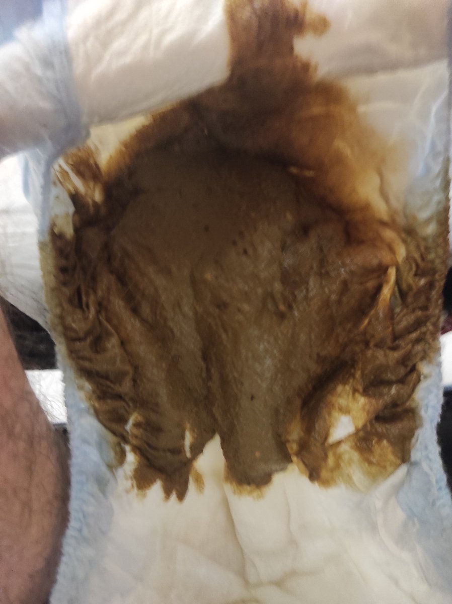 CristianPooping's tweet photo. Quando ti scappa da 💩💩 ma hai il pannolino..... https://t.co/UPj17ci5BQ