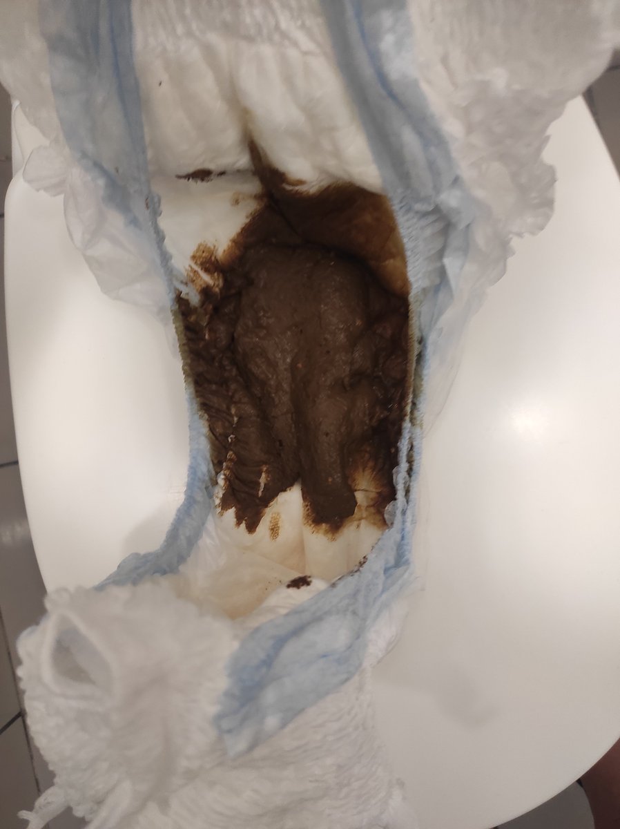 CristianPooping's tweet photo. Quando ti scappa da 💩💩 ma hai il pannolino..... https://t.co/UPj17ci5BQ