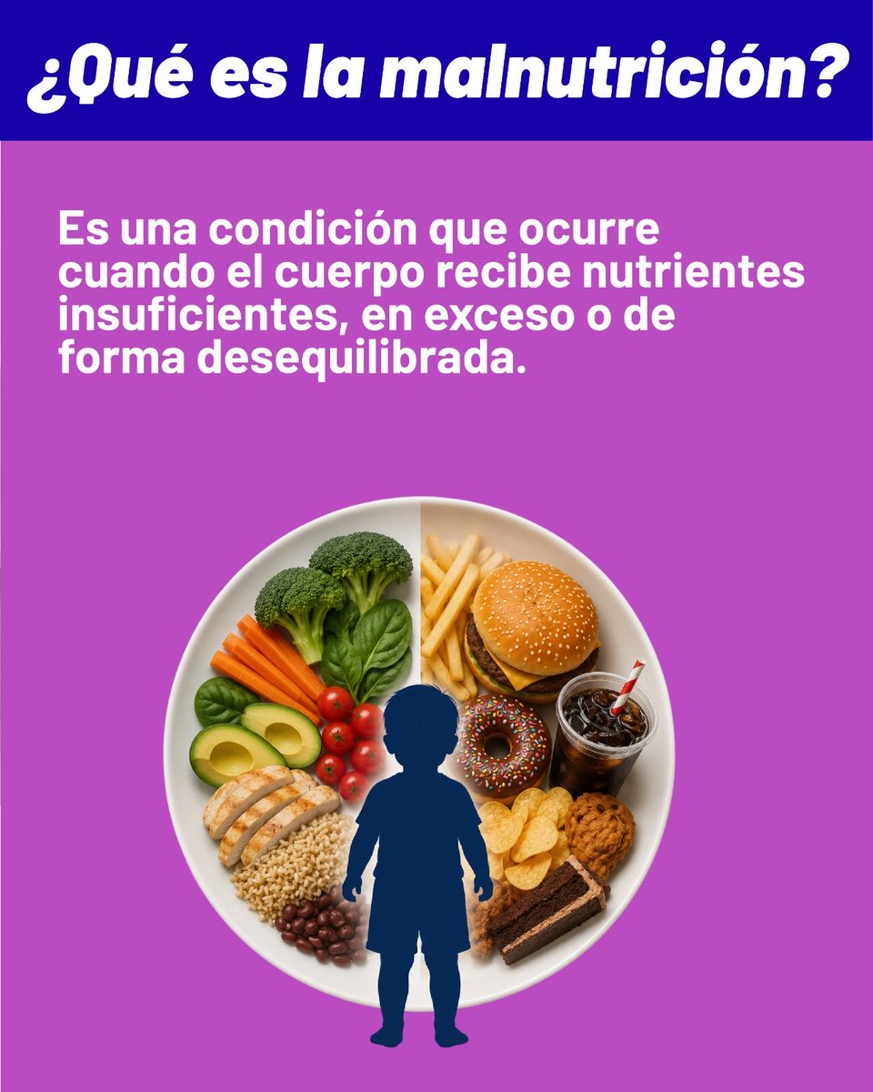 Salud_Ec's tweet photo. 👶🏻La malnutrición no es solo #desnutrición. También incluye la anemia, el sobrepeso y la obesidad, condiciones que pueden afectar el crecimiento, desarrollo y bienestar de niñas y niños. 🍎 https://t.co/auFCzGV8fX