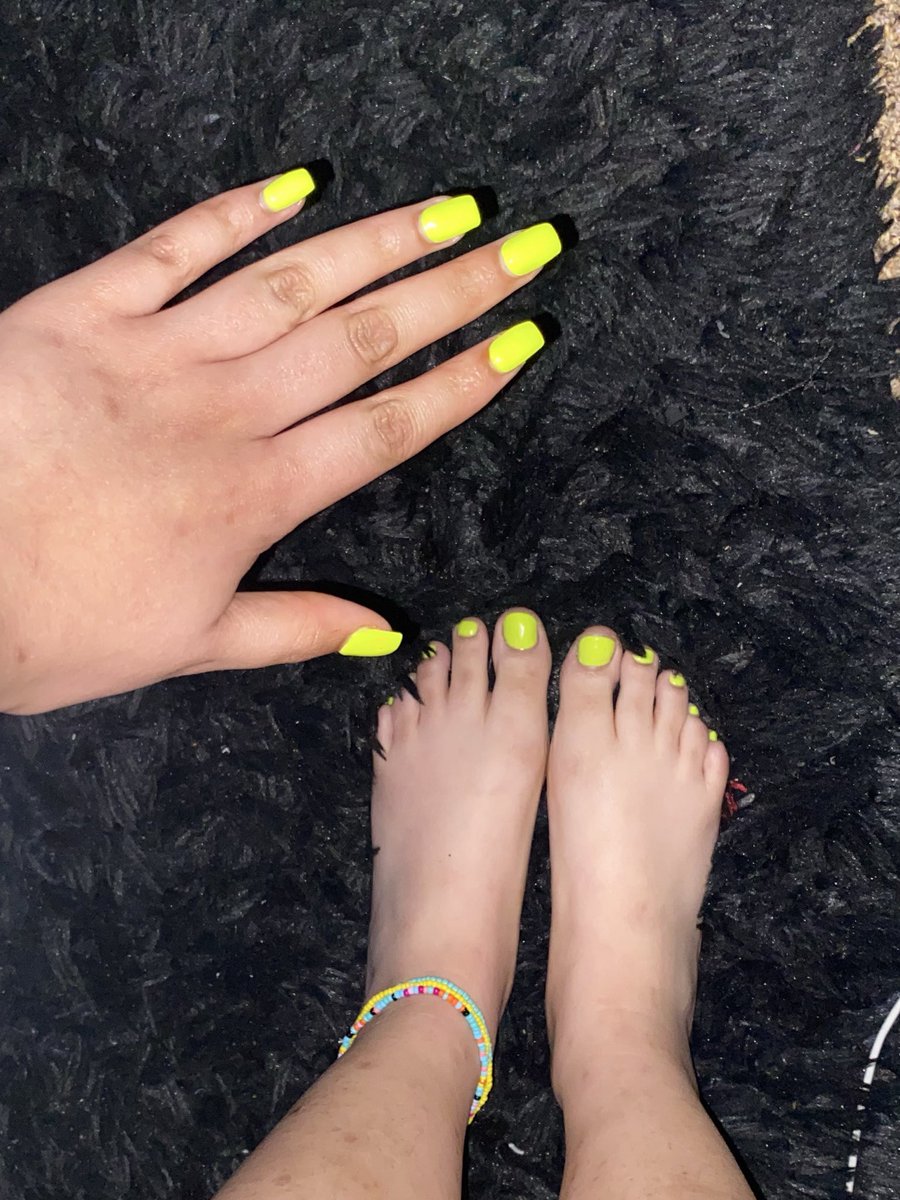 BigMamacasper's tweet photo. As you can see I love some neon toes :) https://t.co/cGac0OSWbj