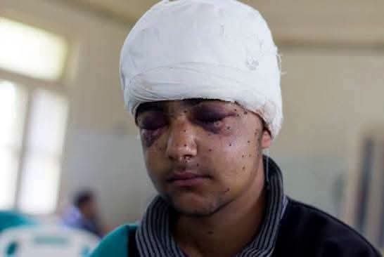 AzgarHossain11's tweet photo. #saveindianstudent #alleyeyonindia #saveindiandemocracy @UN_HRC @UN @EUCouncil @EUCouncilPress @ICJ_Asia @SaarcSec https://t.co/M8g3fhgxvl