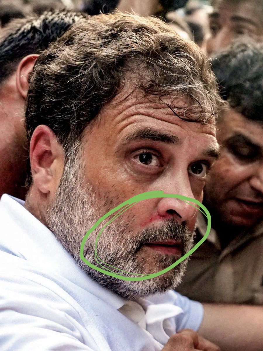 mdjafarsadiq7's tweet photo. ఒక ప్రతిపక్ష నాయకుడిని ఈ విధంగా పోలీసులు దౌర్జన్యంగా వీటికి వెళ్ళటం అనేది కరెక్ట్ కాదు ప్రజాస్వామ్య దేశంలో ప్రతిపక్ష నాయకులకు కూడా విలువ లేకుండా పోతే ప్రజాస్వామ్యాన్ని కాపాడేది ఎవరు? https://t.co/GFHeDvbRxP