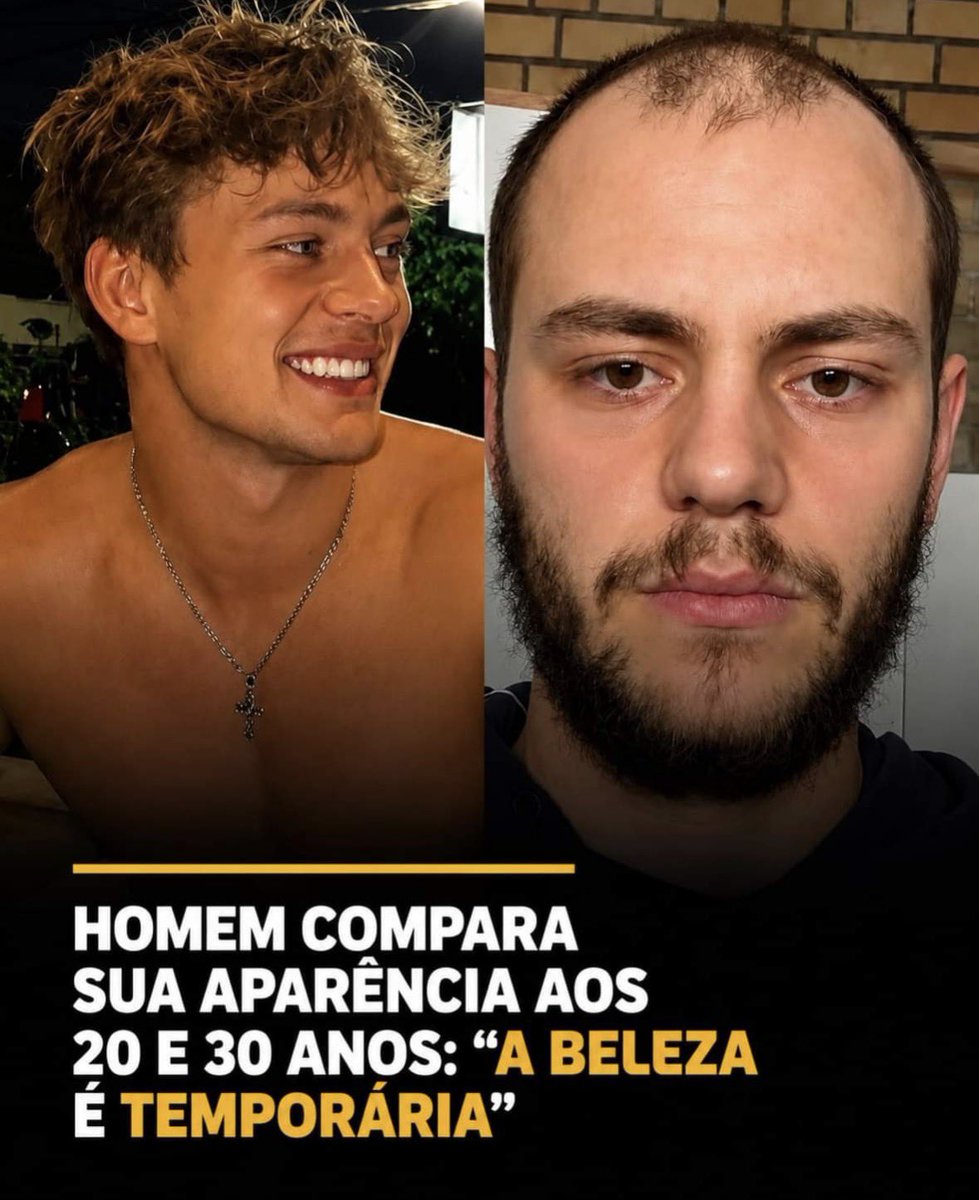 OEstagiari0's tweet photo. 20 vs 30 anos 
A calvice realmente é brutal com o homem https://t.co/w6rEBC5aSs