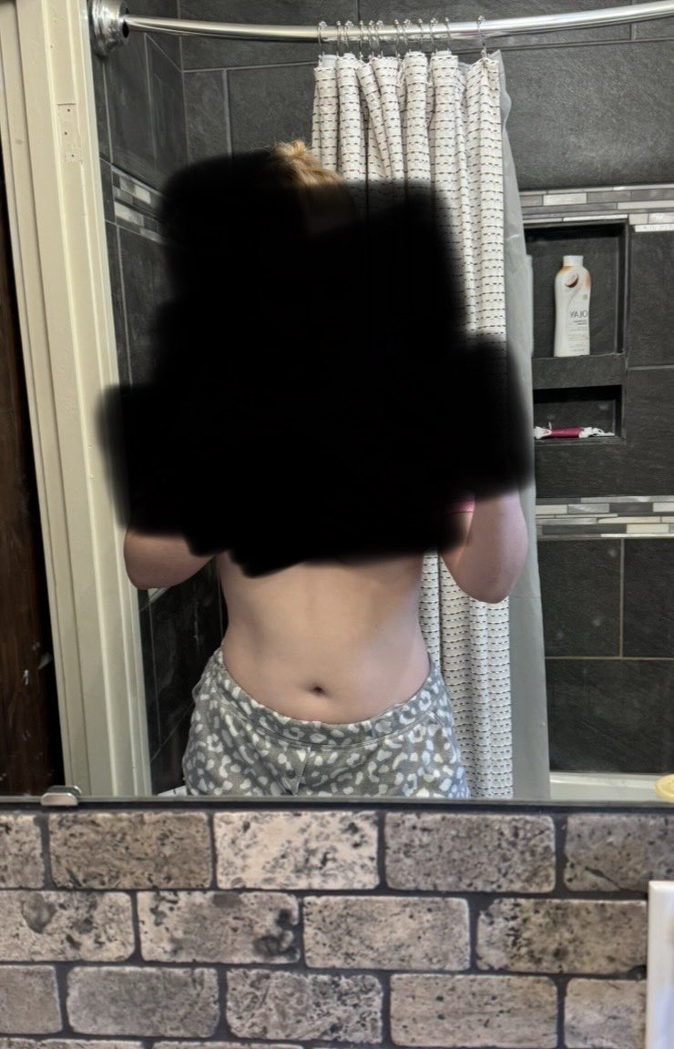 dolliedys's tweet photo. 20lbs down !!! march21st —> july20th https://t.co/HnCa2JKiYg
