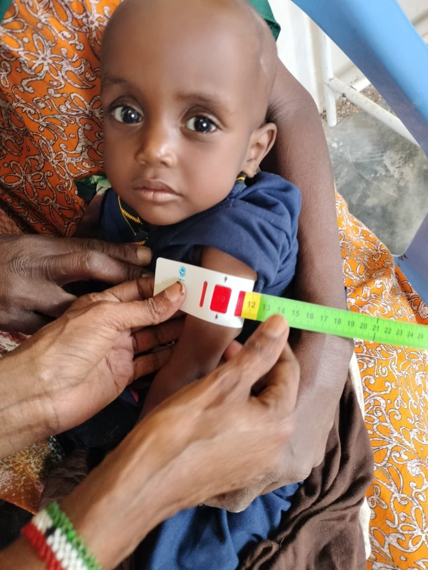 SRC_Reliefteam's tweet photo. Eldheer&amp;Haradheere families  are suffering accumulated crises We SRC believe with little funds Ceelddheer and Xaradheere are neglected since2023 vulnerable families were facing one difficult to another while malnourished U5 are dominant Thanks to @unicef  #Humanitariancrises https://t.co/NJnEQtS4N1