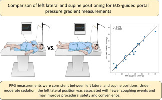 miNitinjagtap's tweet photo. Can you measure #EUS PPG in the left lateral position instead of flipping the patient supine?
@GIE_Journal study: the gradient is equivalent.
✅ But absolute pressures drop ~4 mmHg, and individual agreement spans ±3 mmHg.
https://t.co/hj63LkWqTc
The mean hides the story. 👇
PPG 17.2 (supine) vs 16.7 (lateral), mean paired difference −0.45 mmHg (95% CI −1.05 to 0.15) — inside the margin. Equivalence met. r=0.978.
Two measurements of the same thing in the same patient always correlate. https://t.co/GQc2c7db7p @Gut_BMJ
Bland-Altman limits of agreement: −3.5 to +2.6 mmHg. The group mean is equivalent; the individual patient can differ by ±3 mmHg — enough to cross the CSPH (10) or variceal bleed (12 mmHg) thresholds that actually drive management.
#EUS #EUSPPG #EndoHepatology #PortalHypertension #GIEndoscopy #EndoTwitter #Hepatology #Cirrhosis #LiverTwitter #EvidenceBasedMedicine #MedTwitter @AniruddhaGI @SAASL_Liver @ebtapper