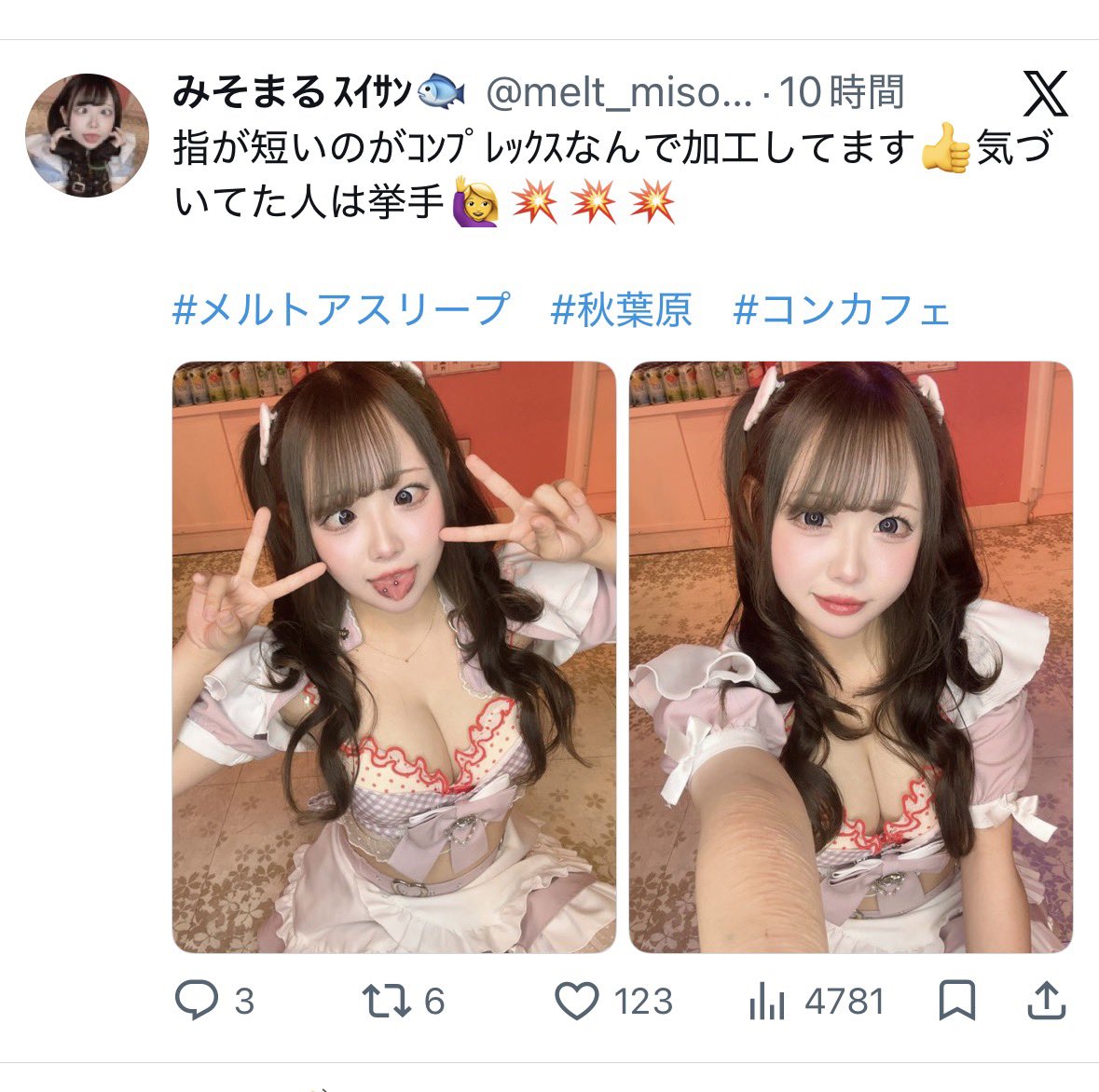 puniyui3team's tweet photo. ズタズタの腕はええんや、、 https://t.co/NjTZTA6xoN