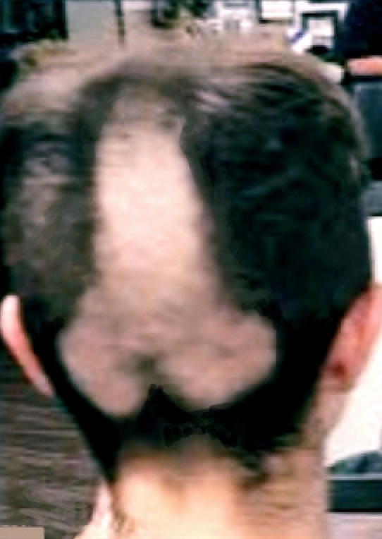 AnilZeks's tweet photo. @JoeyMannarino WIG lol https://t.co/L9NGx1T0uV