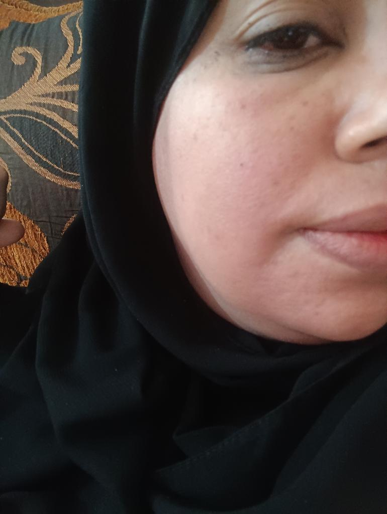 eslamomkhader's tweet photo. (Before and after) ‼️
50$ won't make you poor, but it could save my face and help me buy treatment for a sudden allergic reaction affecting my face😭
https://t.co/mwLTOtMRmH https://t.co/QmLw40Un4c