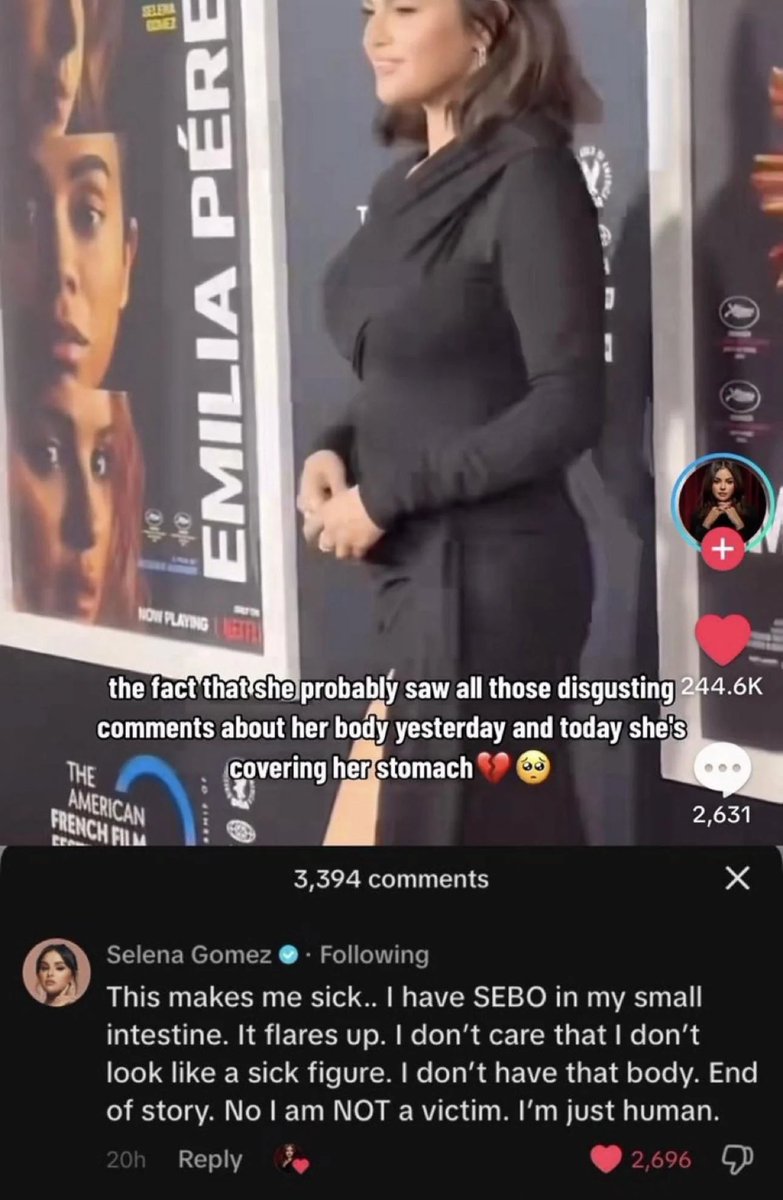 raresblvd's tweet photo. thinking about how badly selena gomez was bodyshamed when she gained weight during her lupus flare up due to her medications that even her ex-boyfriend had to defend her https://t.co/KHeAhcKjEr