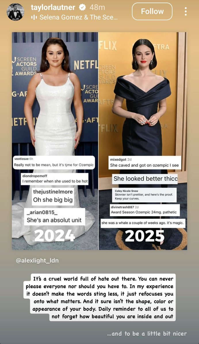 raresblvd's tweet photo. thinking about how badly selena gomez was bodyshamed when she gained weight during her lupus flare up due to her medications that even her ex-boyfriend had to defend her https://t.co/KHeAhcKjEr