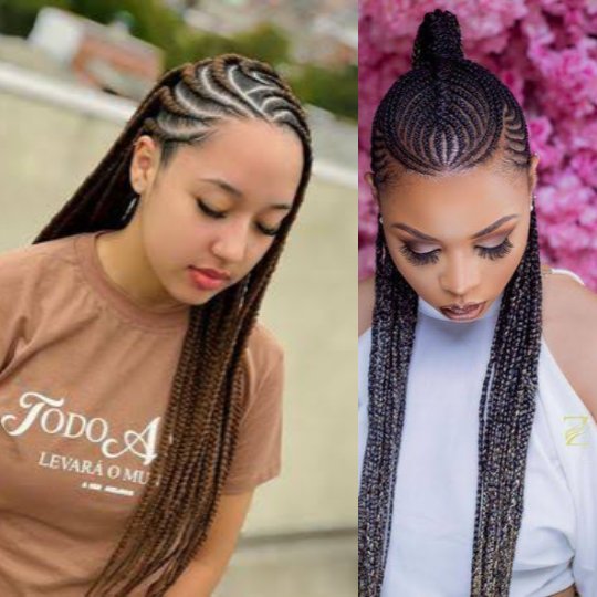 Maryam_care's tweet photo. 💇 Can Hair Extensions Damage Your Hair?

Many women love braids, weaves, and hair extensions because they look beautiful and protect natural hair.

But did you know that wearing hairstyles that are too tight for a long time can damage your hair?

When hair is constantly pulled, it puts stress on the hair follicles. Over time, this can lead to a condition called traction alopecia, where the hairline gradually becomes thinner or hair stops growing in certain areas.

This doesn't mean you should never wear hair extensions.

✔️ The key is to:
Avoid hairstyles that are painfully tight.
Give your hair regular breaks.
Keep your scalp clean.
If you notice pain, bumps, or hair loss around your hairline, loosen the style or remove it.

💡 Beauty should never come at the cost of your hair's health.

💬 Have you ever experienced headaches or hair loss after wearing tight braids or extensions?