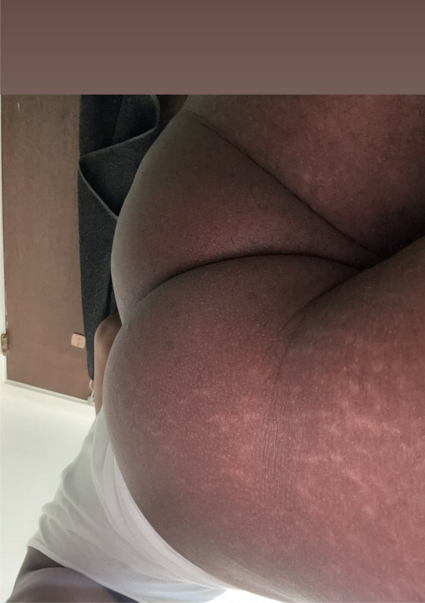 muriiboo's tweet photo. Happy HumpDay🤪
#stl #stlfreaks #573freaks
#901freaks #MOfreaks https://t.co/47hXhWeQnJ