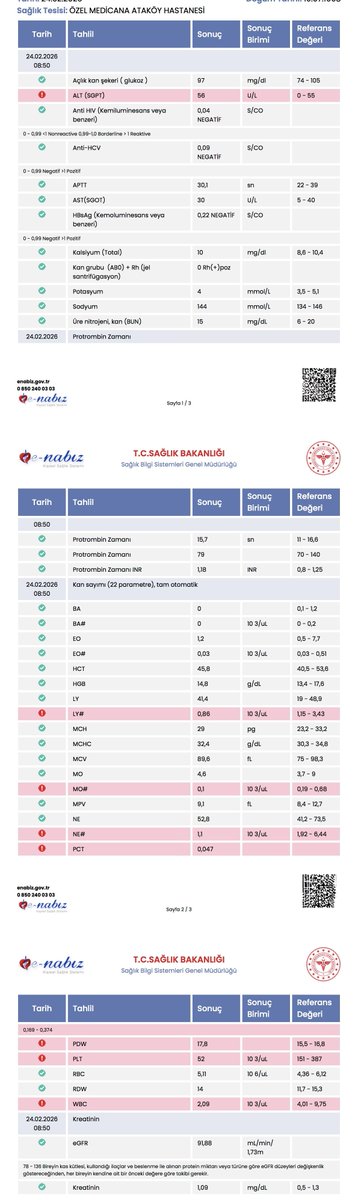 tuketicideney's tweet photo. Medicana Ataköy’de ameliyat sabahı kan değerleri ağır şekilde bozuk olmasına rağmen estetik operasyona alındığını belirten hasta, 7 gün sonra lösemi tanısı aldığını ve kalıcı görme kaybı yaşadığını söylüyor.

♦️Takipçi şikâyeti:

“24 Şubat’ta Medicana Ataköy Hastanesi’nde Prof. Dr. Harun Ç. tarafından jinekomasti ameliyatı oldum.

Ameliyat sabahı hastanede kan testlerim yapıldı ve ardından doğrudan operasyona alındım.

Tahlil sonuçlarımı daha sonra kendim incelediğimde trombosit (PLT) değerimin 52 bin olduğunu gördüm. Raporda normal alt sınır 151 bin olarak görünüyordu. Lökosit dâhil birçok değerim de referans aralığının çok altındaydı ve sonuçlar kırmızı renkle, ünlem işaretiyle belirtilmişti.

Bu sonuçlar hakkında ameliyat öncesinde bana hiçbir bilgi verilmedi.

Ameliyat sonrasında dinlenme odasında ağır kanama yaşadım. Buna rağmen birkaç saat içinde aynı gün taburcu edildim. Taburcu edilirken de tahlil sonuçlarım bana gösterilmedi ve her şey normalmiş gibi davranıldı.

Eve gittikten sonra durumum giderek kötüleşti. Nabzım 120-130’a çıkıyor, şiddetli baş ağrısı ve halsizlik yaşıyordum. Ayakta duramaz hâle geldim ve ameliyat bölgemde büyük morluklar oluştu.

Yaşadığım tüm belirtileri ve fotoğrafları WhatsApp üzerinden defalarca hekime ilettim. Bana her seferinde bunların normal olduğu ve geçeceği söylendi. Muayeneye çağrılmadım ve yeniden kan tahlili yapılmadı.

Yedinci günün sonunda görmem bulanıklaştı ve yataktan kalkamaz hâle geldim. Ailemin yardımıyla başka bir hastanenin acil servisine götürüldüm. Yapılan tetkiklerin ardından lösemi tanısı aldım.

Trombosit değerlerimin çok düşük olması nedeniyle gözümde kanama meydana geldi. Bu nedenle göz ameliyatı oldum ve yaklaşık bir ay hastanede yatarak tedavi gördüm.

Tedavimi üstlenen hekimler, durumumun son derece ciddi olduğunu ve daha fazla gecikmenin çok ağır sonuçlar doğurabileceğini ifade ettiler. Ayrıca ameliyat öncesi kan değerlerimin ciddi bir hastalığa işaret ettiğini ve mutlaka değerlendirilmesi gerektiğini söylediler.

Kan değerlerimdeki ağır bozukluklara rağmen neden acil olmayan estetik bir ameliyata alındığımı öğrenmek istiyorum.

Trombosit değerim 52 bin olduğu hâlde operasyon neden ertelenmedi ve neden hematoloji konsültasyonu istenmedi?

Ameliyat sonrasında kanama yaşamama rağmen neden aynı gün taburcu edildim ve kan değerlerim neden yeniden kontrol edilmedi?

Günlerce ilettiğim şikâyetler neden ‘Normal, geçecek’ denilerek değerlendirildi ve neden muayeneye çağrılmadım?

Yaşadıklarımı ilettiğimde bir açıklama ve özür bekledim. Ancak tarafıma dava açabileceğimin söylendiğini belirtiyorum.

Hukuki süreci başlattım. Yaşadığım bu süreci, aynı durumun başka hastaların da başına gelmemesi için paylaşıyor ve Medicana Ataköy Hastanesi ile ilgili hekimden ayrıntılı bir açıklama bekliyorum.”