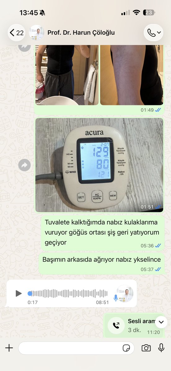 tuketicideney's tweet photo. Medicana Ataköy’de ameliyat sabahı kan değerleri ağır şekilde bozuk olmasına rağmen estetik operasyona alındığını belirten hasta, 7 gün sonra lösemi tanısı aldığını ve kalıcı görme kaybı yaşadığını söylüyor.

♦️Takipçi şikâyeti:

“24 Şubat’ta Medicana Ataköy Hastanesi’nde Prof. Dr. Harun Ç. tarafından jinekomasti ameliyatı oldum.

Ameliyat sabahı hastanede kan testlerim yapıldı ve ardından doğrudan operasyona alındım.

Tahlil sonuçlarımı daha sonra kendim incelediğimde trombosit (PLT) değerimin 52 bin olduğunu gördüm. Raporda normal alt sınır 151 bin olarak görünüyordu. Lökosit dâhil birçok değerim de referans aralığının çok altındaydı ve sonuçlar kırmızı renkle, ünlem işaretiyle belirtilmişti.

Bu sonuçlar hakkında ameliyat öncesinde bana hiçbir bilgi verilmedi.

Ameliyat sonrasında dinlenme odasında ağır kanama yaşadım. Buna rağmen birkaç saat içinde aynı gün taburcu edildim. Taburcu edilirken de tahlil sonuçlarım bana gösterilmedi ve her şey normalmiş gibi davranıldı.

Eve gittikten sonra durumum giderek kötüleşti. Nabzım 120-130’a çıkıyor, şiddetli baş ağrısı ve halsizlik yaşıyordum. Ayakta duramaz hâle geldim ve ameliyat bölgemde büyük morluklar oluştu.

Yaşadığım tüm belirtileri ve fotoğrafları WhatsApp üzerinden defalarca hekime ilettim. Bana her seferinde bunların normal olduğu ve geçeceği söylendi. Muayeneye çağrılmadım ve yeniden kan tahlili yapılmadı.

Yedinci günün sonunda görmem bulanıklaştı ve yataktan kalkamaz hâle geldim. Ailemin yardımıyla başka bir hastanenin acil servisine götürüldüm. Yapılan tetkiklerin ardından lösemi tanısı aldım.

Trombosit değerlerimin çok düşük olması nedeniyle gözümde kanama meydana geldi. Bu nedenle göz ameliyatı oldum ve yaklaşık bir ay hastanede yatarak tedavi gördüm.

Tedavimi üstlenen hekimler, durumumun son derece ciddi olduğunu ve daha fazla gecikmenin çok ağır sonuçlar doğurabileceğini ifade ettiler. Ayrıca ameliyat öncesi kan değerlerimin ciddi bir hastalığa işaret ettiğini ve mutlaka değerlendirilmesi gerektiğini söylediler.

Kan değerlerimdeki ağır bozukluklara rağmen neden acil olmayan estetik bir ameliyata alındığımı öğrenmek istiyorum.

Trombosit değerim 52 bin olduğu hâlde operasyon neden ertelenmedi ve neden hematoloji konsültasyonu istenmedi?

Ameliyat sonrasında kanama yaşamama rağmen neden aynı gün taburcu edildim ve kan değerlerim neden yeniden kontrol edilmedi?

Günlerce ilettiğim şikâyetler neden ‘Normal, geçecek’ denilerek değerlendirildi ve neden muayeneye çağrılmadım?

Yaşadıklarımı ilettiğimde bir açıklama ve özür bekledim. Ancak tarafıma dava açabileceğimin söylendiğini belirtiyorum.

Hukuki süreci başlattım. Yaşadığım bu süreci, aynı durumun başka hastaların da başına gelmemesi için paylaşıyor ve Medicana Ataköy Hastanesi ile ilgili hekimden ayrıntılı bir açıklama bekliyorum.”