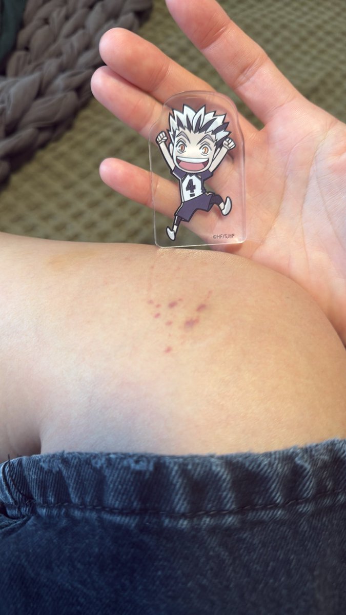 jinsbuttcheeks's tweet photo. @alwaystaetime it’s hard to see in the first pic i posted but it actually looks Worse Than That 

bokuto appearance for a hehe https://t.co/dhskFlslx2