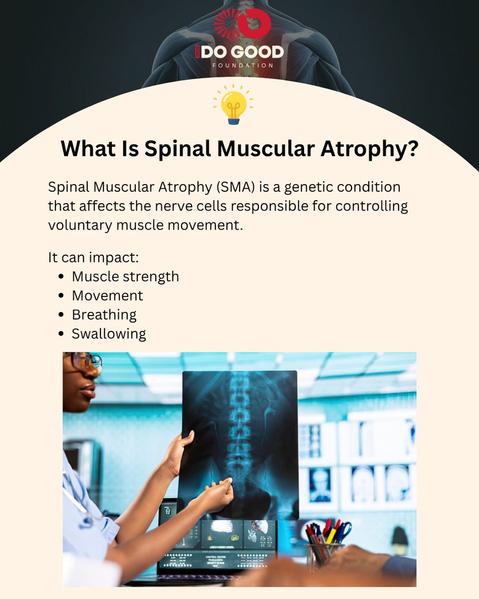 TheSoulofSanta's tweet photo. 💡 Spinal Muscular Atrophy is a genetic condition affecting the nerve cells that control voluntary muscle movement.

Awareness, accessible care, and individualized support can make a meaningful difference.

#SMAAwareness #DisabilityEducation https://t.co/VBHX3EUlX7
