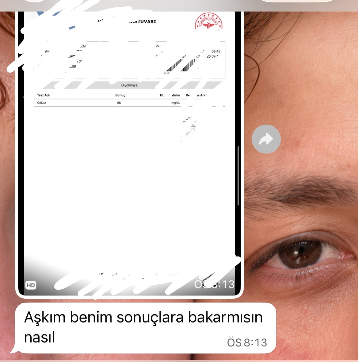 cicikuss31's tweet photo. 5 fava bana aşkından ölüyorsun 2 haftalık ömrün kalmış yazarım https://t.co/nv9RU53tm7