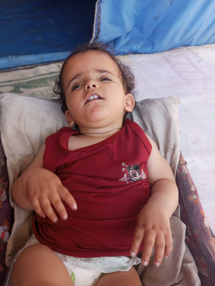 YwsfG89270's tweet photo. Dear kind-hearted people, my little girl (14 months old) has a congenital condition that impairs her mobility. She needs special orthopedic shoes and intensive daily physiotherapy. The cost is approximately €500. Any help, even just one euro, makes a big difference. Donate via https://t.co/Dyw6RoFdIs