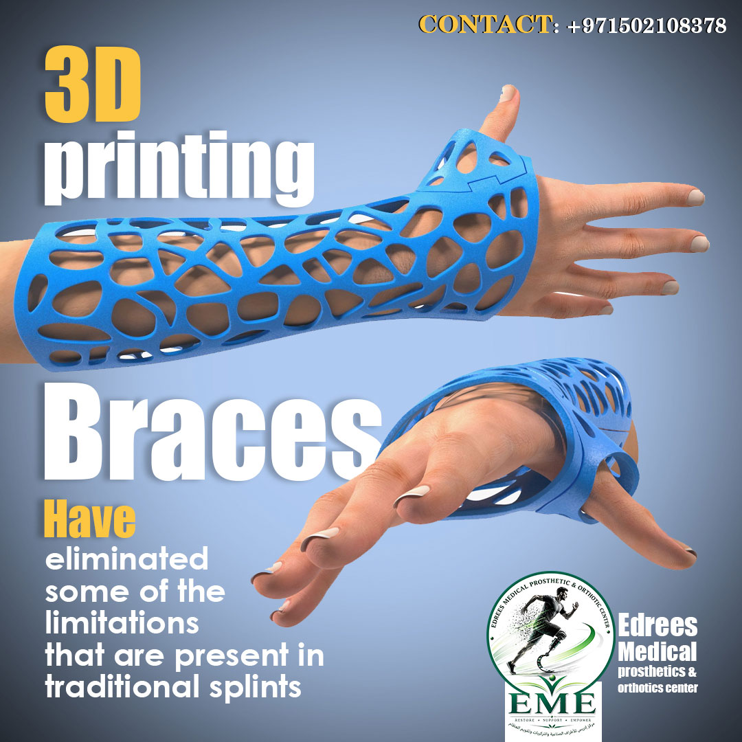 EdreesEME's tweet photo. Advanced 3D Printed Braces | Precision Fit with 3D Hand Scanning

Experience the future of orthotic care with Edrees Medical Prosthetic &amp; Orthotic Center.

#EdreesMedical #3DPrintedBraces #3DScanning #Orthotics #Prosthetics #WristBrace #HandBrace #CustomBrace #MedicalTechnology https://t.co/6hb6afmtOu