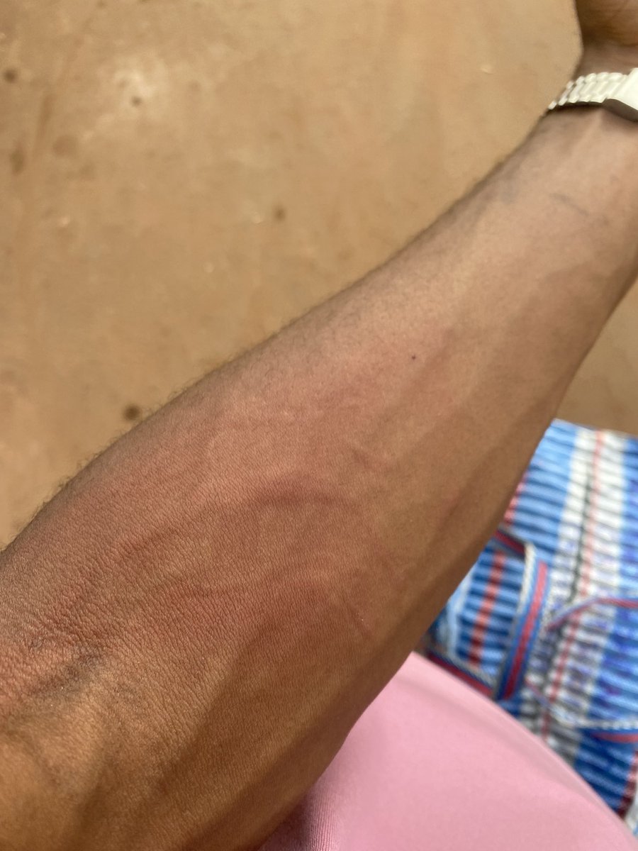 heismarts's tweet photo. Masquerade wan finish me for this school😭😭 https://t.co/HLnpMQoqBK