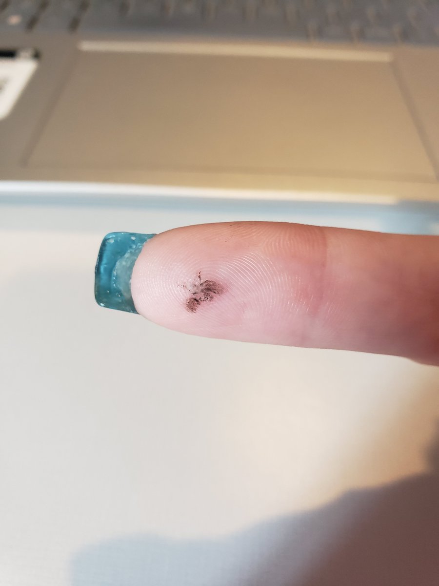 SarahIsTits's tweet photo. Squished this fly at work and it left this perfect dust outline https://t.co/vmekM3aCZY