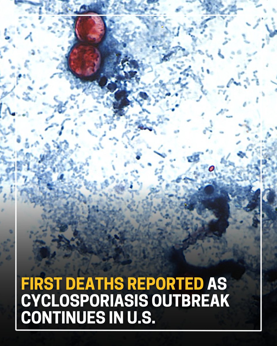 KCBD11's tweet photo. The U.S. is facing its largest cyclospora outbreak to date with 45 states reporting cases since May. Find the latest updates here >> https://t.co/gWDAaoWhCQ https://t.co/MzDeIZtSfO