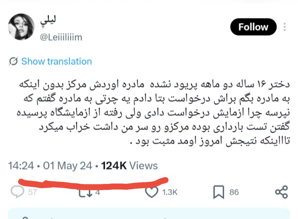 mehranshad's tweet photo. البته دختره الان ۱۸ سالشه و بچه‌ش داره کم کم حرف زدن یاد میگیره https://t.co/kL7tBcZaMJ