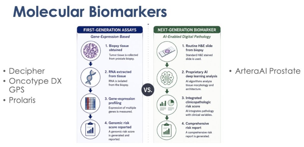 urotoday's tweet photo. Point-Counterpoint đ§Ź Do molecular biomarkers justify encouraging active surveillance (AS) in localized #ProstateCancer?
Dr. @zklaassen_md @GACancerCenter at #USPCC26: They informâbut shouldn't independently driveâAS decisions yet.
Key points:
â
AS is already SOC for low-risk disease with excellent long-term MFS/CSS
â
Biomarkers (Decipher, Oncotype GPS, Prolaris, ArteraAI) show clinical validity (prognosis) but lack prospective clinical utility (changing management â better outcomes)
â
PASS study: adding GPS to clinical models gave minimal incremental value; association attenuated after adjusting for PSA density
â ď¸ Tumor heterogeneity complicates interpretation (targeted vs systematic cores can disagree)
đŻ What's needed: prospective, MRI-era, biomarker-guided RCT showing reduced overtreatment without compromising safety
Written coverage by @RKSayyid @UAUrology on UroToday > https://t.co/yrBeceCrqw @PCFnews