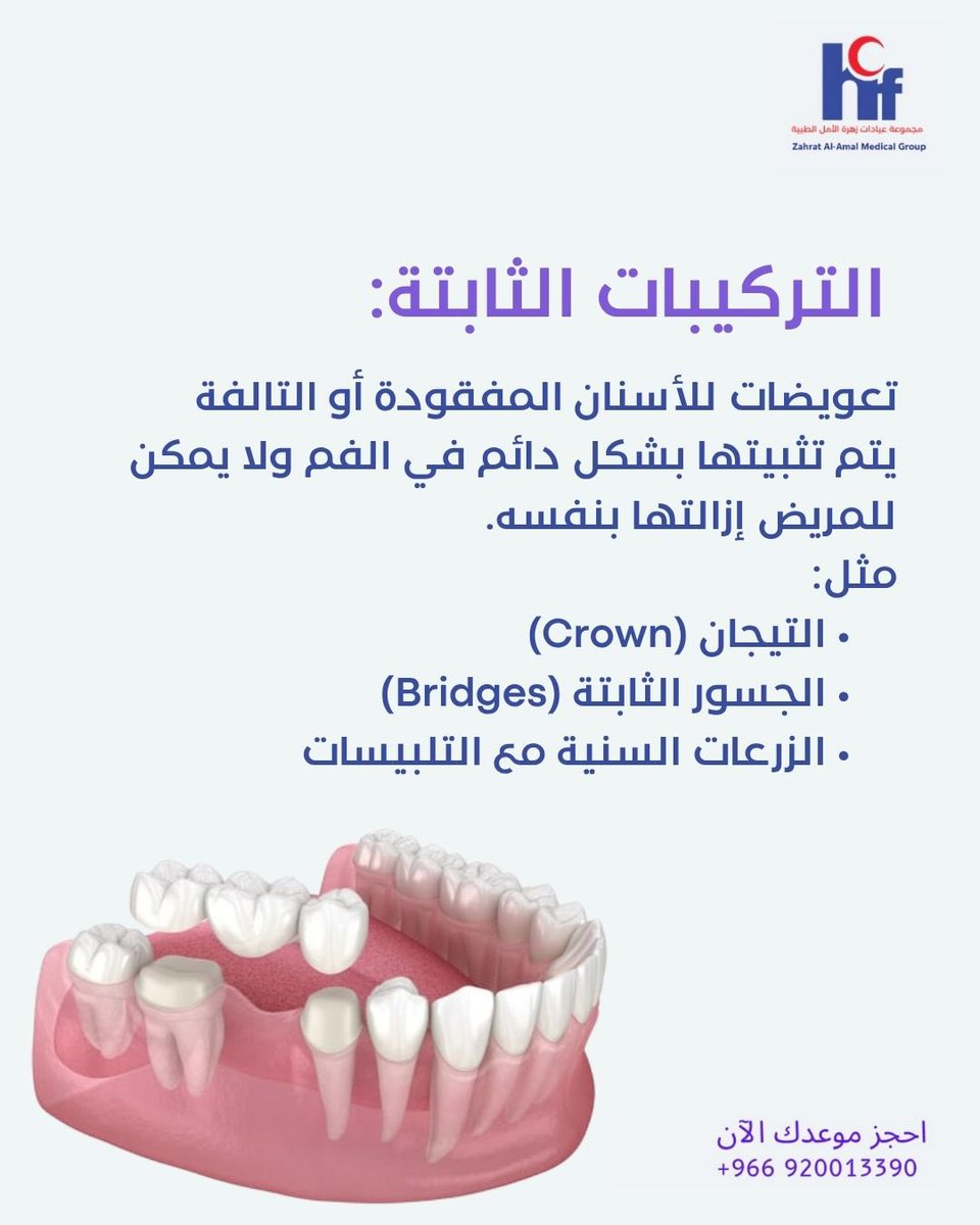ZAAMCsa's tweet photo. ما الفرق بين التركيبات الثابتة والمتحركة للأسنان؟

 #زهرة_الأمل https://t.co/R37Is4T1pS