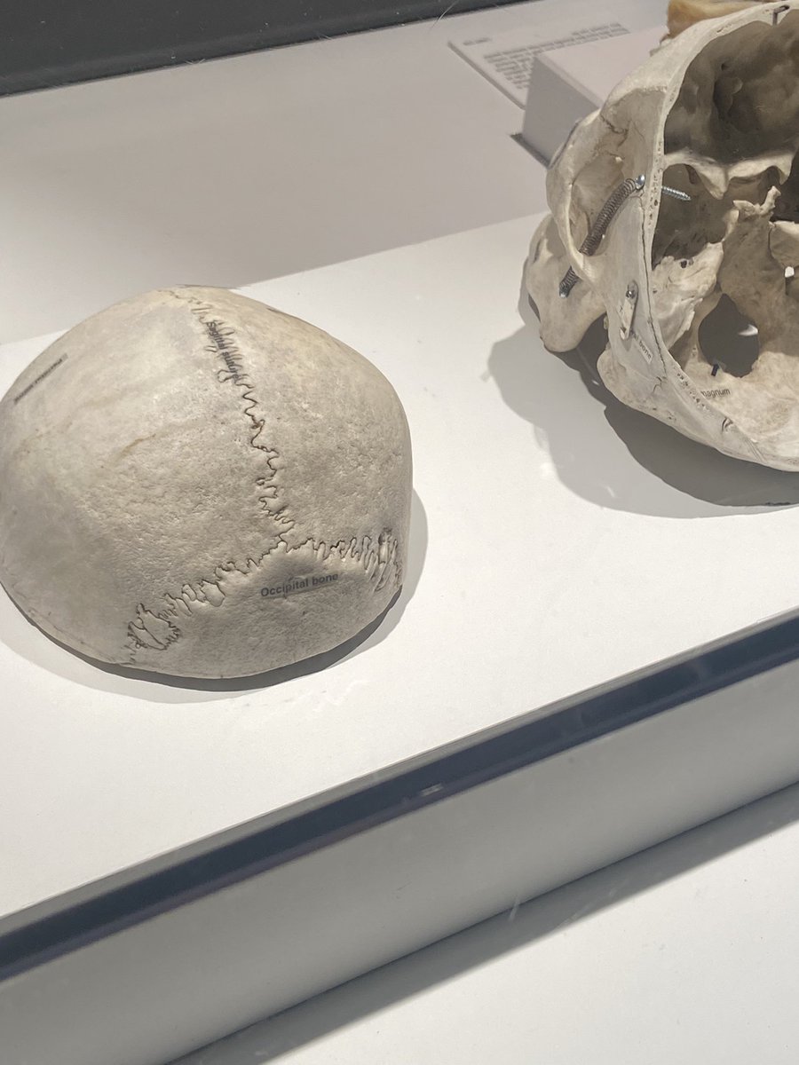 wernickeBA22's tweet photo. find the bone sutures cool https://t.co/lAvb3Y2b5t
