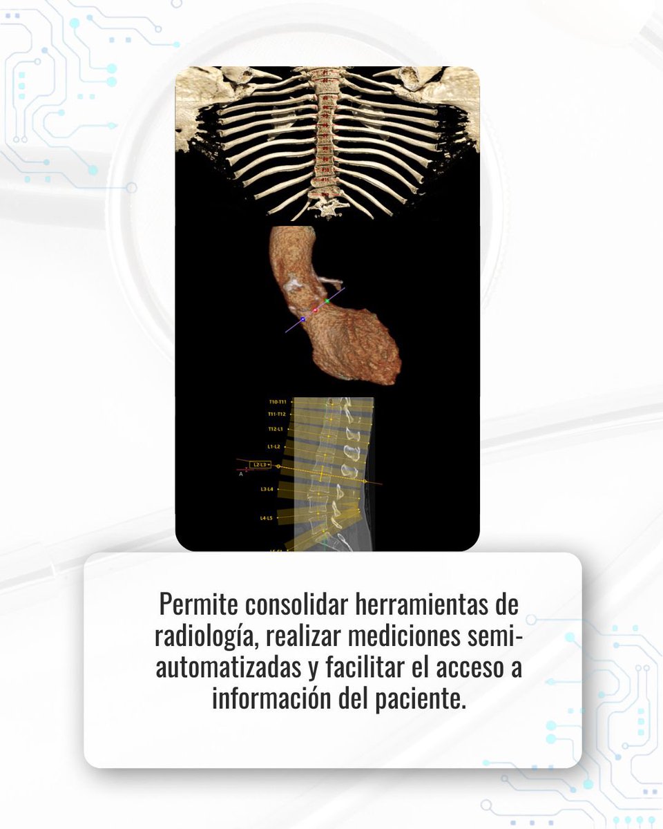 reserma's tweet photo. ✨ La innovación médica no depende solo de los equipos físicos.  
El software también cumple un papel clave en cómo se visualizan, analizan y comparten las imágenes médicas.

https://t.co/qekW8ij2IG https://t.co/n8jUTdybnc