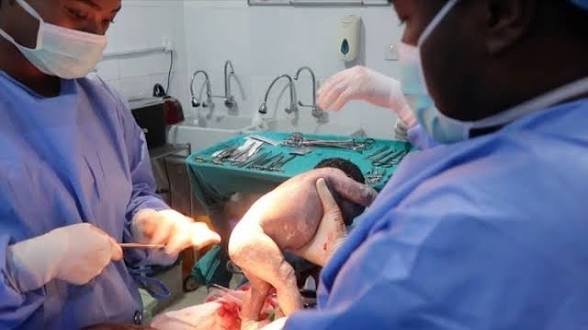 ennyola0015's tweet photo. They won't tell you this:

President Tinubu's administration has been funding free Caesarean Sections for indigent and vulnerable pregnant women under the Comprehensive Emergency Obstetric and Neonatal Care (CEmONC) programme.

More than 32,000 women have already benefited. https://t.co/IWlCLF8kWq