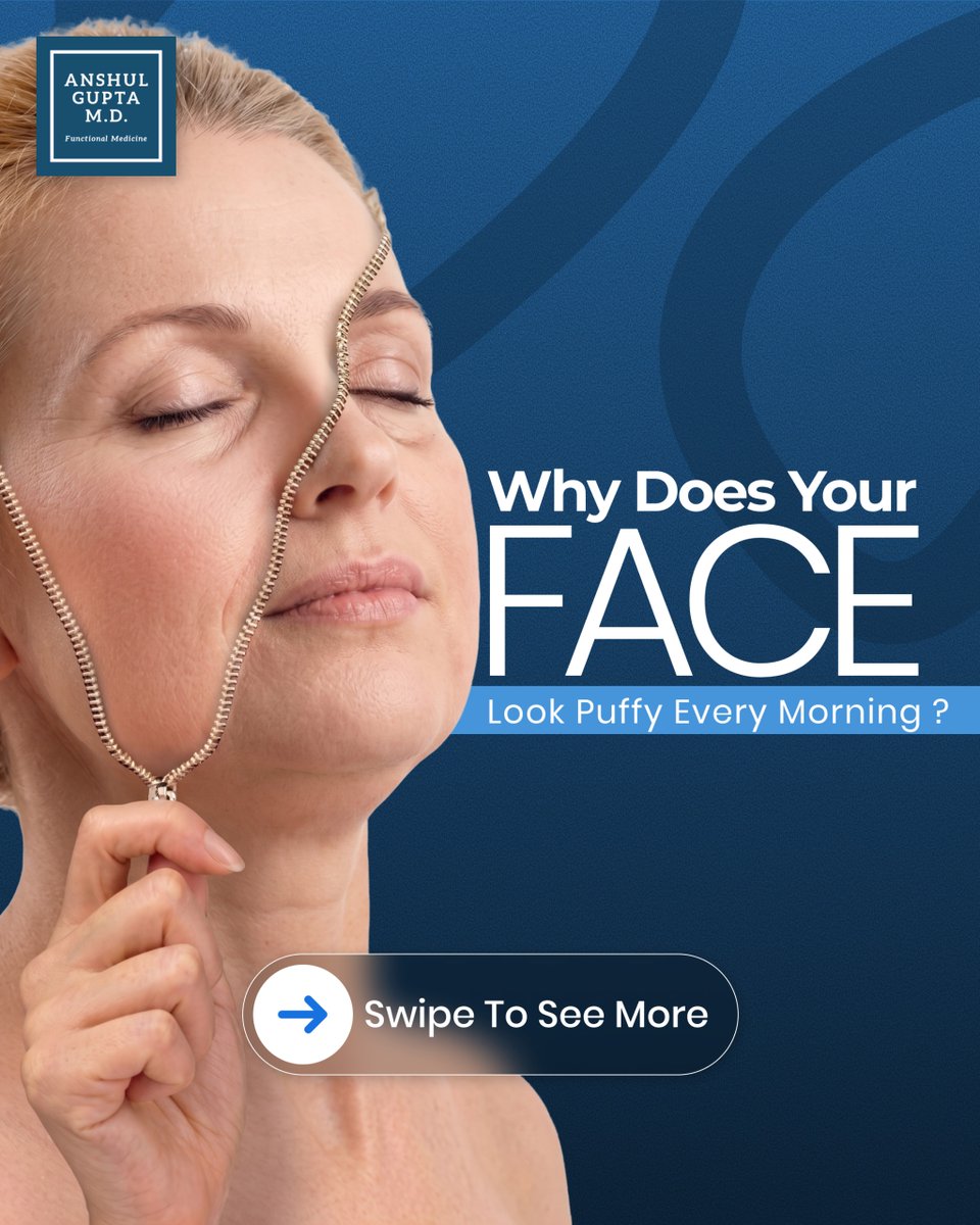 anshulguptamd's tweet photo. Your face might be telling you more than you think.

Morning puffiness isn't always "just poor sleep". Factors like hydration, inflammation, nutrition, and thyroid health may all play a role.

Small clues can reveal a bigger picture. 👇

#ThyroidHealth #FunctionalMedicine https://t.co/mT6sii1dWt