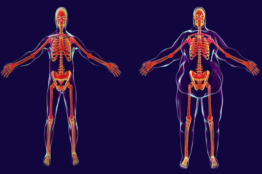 ArtSeduccin1's tweet photo. La grasa abdominal está relacionada con:

• C@ncer
• Diabetes
• Enfermedad cardíaca

Después de más de 10 años en el gimnasio...

Aquí tienes todos los consejos que tengo para eliminar la grasa de tu barriga:

1. Deja de correr si tienes sobrepeso https://t.co/eWQ1r62vBO