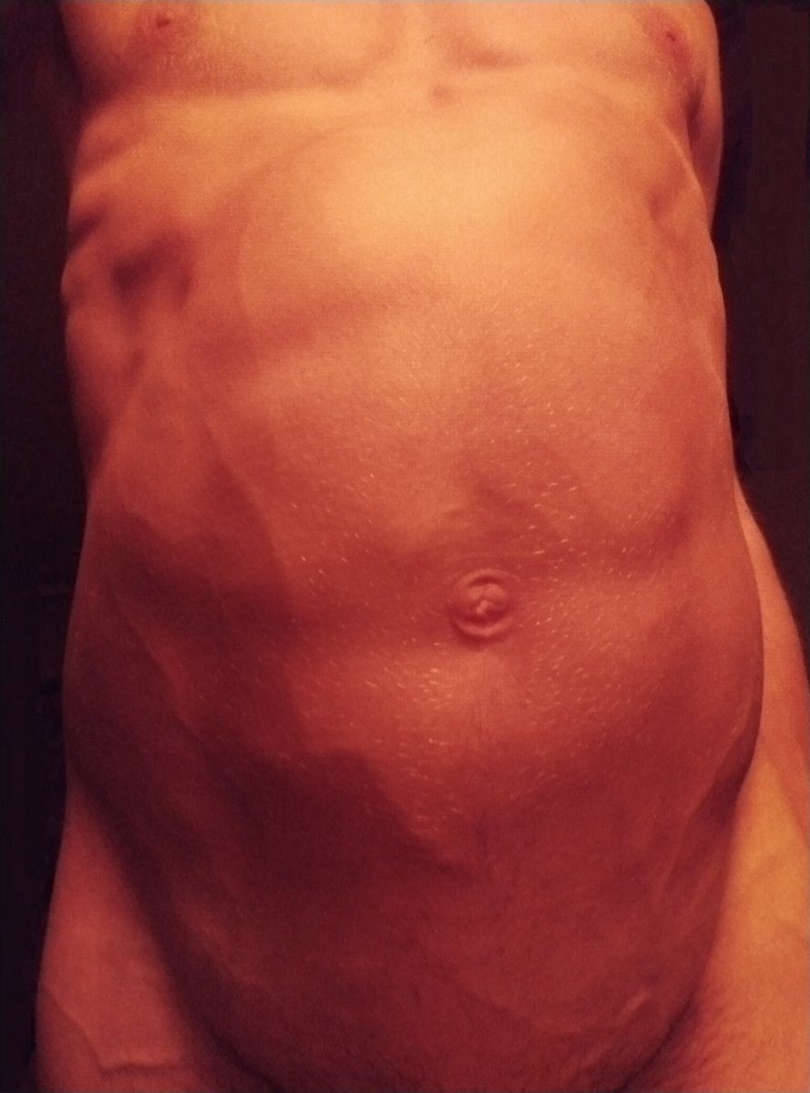 TonicInflator's tweet photo. Before / After
#belly_inflation https://t.co/6Wb2gL1GFO