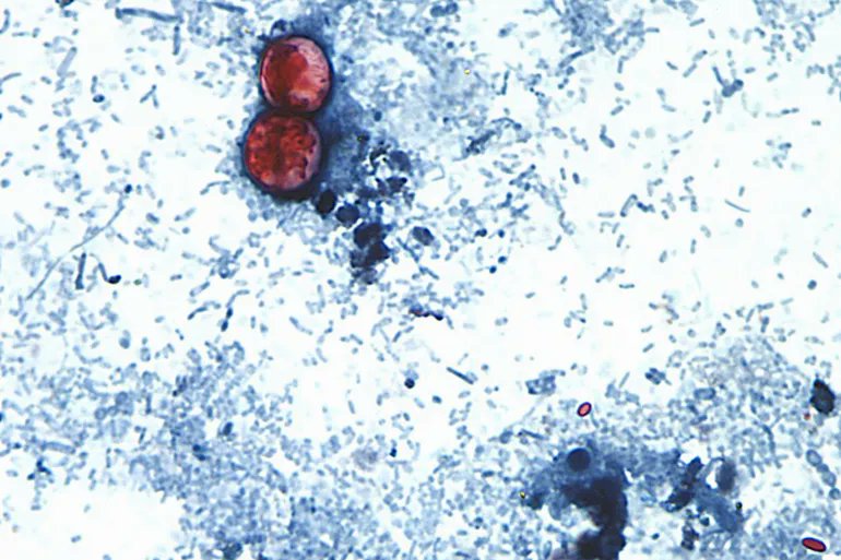AJEnglish's tweet photo. Authorities in the US state of Michigan say that they have confirmed the deaths of two people in a cyclospora outbreak, the first fatal cases of a disease related to the microscopic parasite recorded in the US https://t.co/7NOVUkXMGI https://t.co/FcVAsUNoQ6