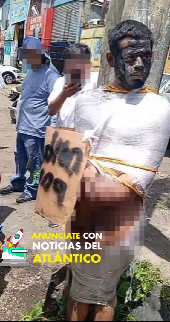 Noti_Atlantico's tweet photo. 🔴 #URGENTE | ❞𝗣𝗢𝗥 𝗟𝗔𝗗𝗥𝗢́𝗡, 𝗠𝗘 𝗥𝗢𝗕𝗘 𝗨𝗡𝗔 𝗠𝗢𝗧𝗢❞ ES AMARRADO DE PIES Y MANOS EN #ZONA8 CAPITALINA. 

Ladrón se salvó de ser qu3mad0 en Calzada Atanasio Tzul y 36 calle #Zona8, luego de ser sorprendido intendando robar una motocicleta. 

Ciudadanos cansados de tanta delincuencia exigían justicia por mano propia y decidieron amarrarlo de pies y manos contra un poste, colocándole un cartón con la frase:  ❞𝑷𝑶𝑹 𝑳𝑨𝑫𝑹𝑶́𝑵, 𝑴𝑬 𝑹𝑶𝑩𝑬 𝑼𝑵𝑨 𝑴𝑶𝑻𝑶❞. Agentes de la #PNC se hicieron presentes al lugar y retomaron el orden público.  

#𝐒𝐨𝐦𝐨𝐬𝐍𝐨𝐭𝐢𝐜𝐢𝐚𝐬𝐃𝐞𝐥𝐀𝐭𝐥𝐚́𝐧𝐭𝐢𝐜𝐨 ⚠️
𝐓𝐨𝐝𝐚 𝐥𝐚 𝐢𝐧𝐟𝐨𝐫𝐦𝐚𝐜𝐢𝐨́𝐧 𝐚𝐥 𝐚𝐥𝐜𝐚𝐧𝐜𝐞 𝐝𝐞 𝐭𝐮 𝐝𝐢𝐬𝐩𝐨𝐬𝐢𝐭𝐢𝐯𝐨 📲

🔞 𝗩𝗜𝗗𝗘𝗢 𝗘 𝗜𝗠𝗔́𝗚𝗘𝗡𝗘𝗦 𝙎𝙄𝙉 𝘾𝙀𝙉𝙎𝙐𝙍𝘼 𝗘𝗡 𝗡𝗨𝗘𝗦𝗧𝗥𝗢 𝗚𝗥𝗨𝗣𝗢 𝗗𝗘 𝗧𝗘𝗟𝗘𝗚𝗥𝗔𝗠

⬇️⬇️⬇️
https://t.co/rl73rMLLZP