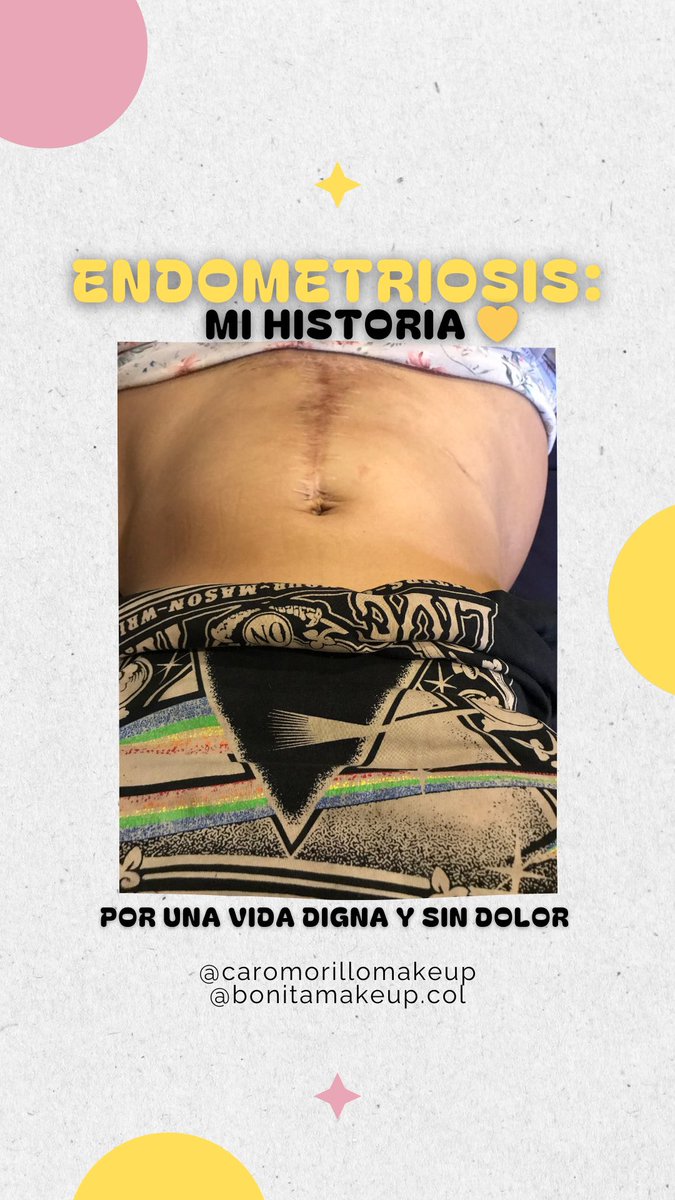 Caromorillo16's tweet photo. Abro hilo 🧵para visibilizar la vulneración a mis derechos😞Es increíble que en Colombia tengamos una Ley de #endometriosis Ley 2328 y ni siquiera con una TUTELA y un DESACATO a favor, la @EPS_Sanitas me garantice la atención médica integral que necesito.@MinSaludCol @Supersalud https://t.co/CcoC9ZdpNt