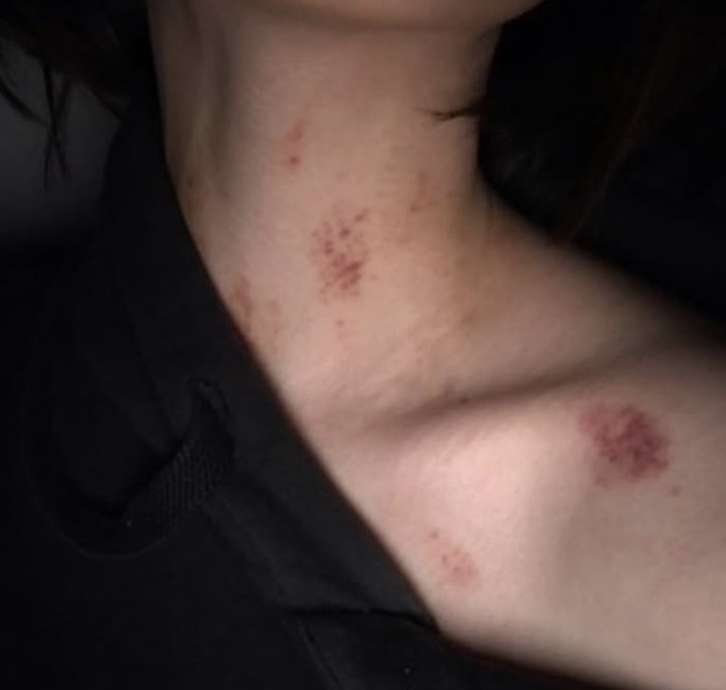 kye_is_ded's tweet photo. mood board - bruh I love hickys like yes suck my neck and leave bruises
Like please
#hickys #freakytwt #subtwt https://t.co/8AZUhCFXrR