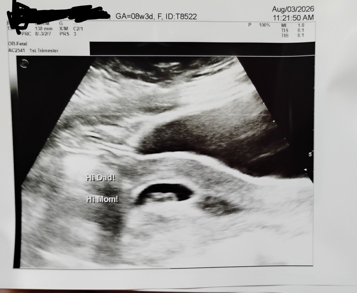 theonetimfrom91's tweet photo. It is official... 7 weeks and 1 day.   You are looking at @lifeaslightning and my baby.   Lucrezia or Crispin    we don't know yet. Lightning edited the picture to hid her name and date of birth. https://t.co/lnkGUnCW40