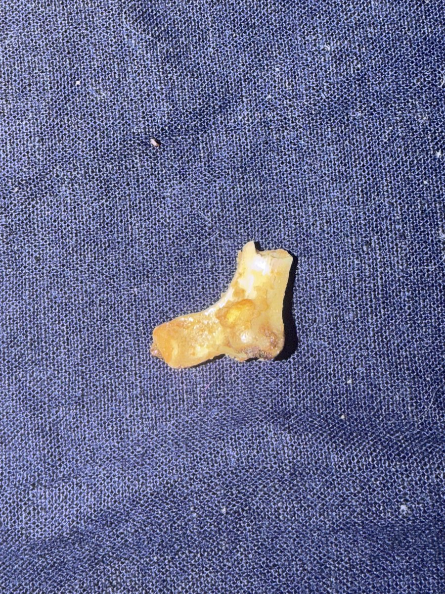 Babydoodad's tweet photo. Pretty gross experience today. I found what appears to be a 1-inch bone in a sealed container of Planters Honey Roasted Peanuts purchased at Kroger. I discovered it while CHEWING. WHAT IN THE WORLD PLANTERS?!?!?!! YUCK!! 🤮 @HormelFoods  @kroger https://t.co/HA30fQ9iCy