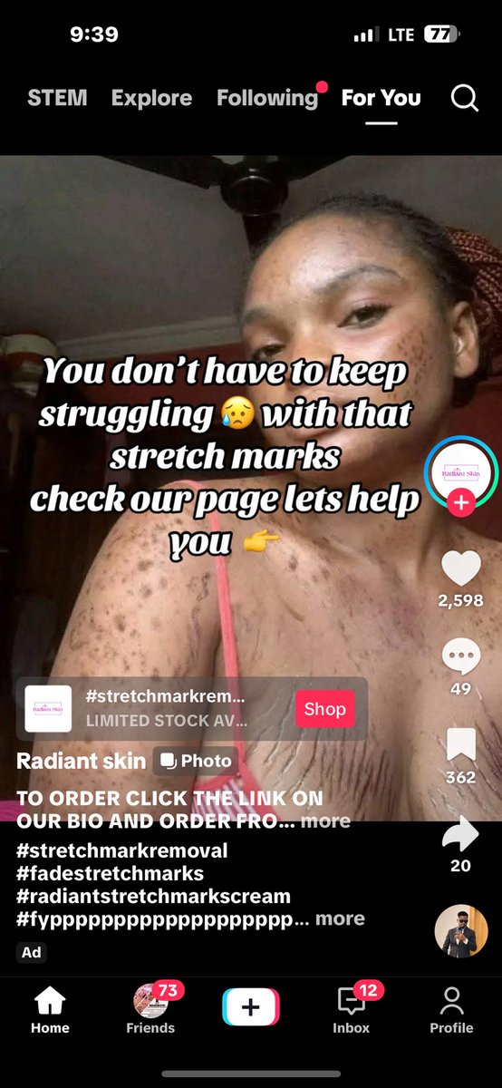 Instincttechng's tweet photo. @Brattyenori13 Dem don spoil your life for TikTok 😂😂 https://t.co/QlpItx9roX