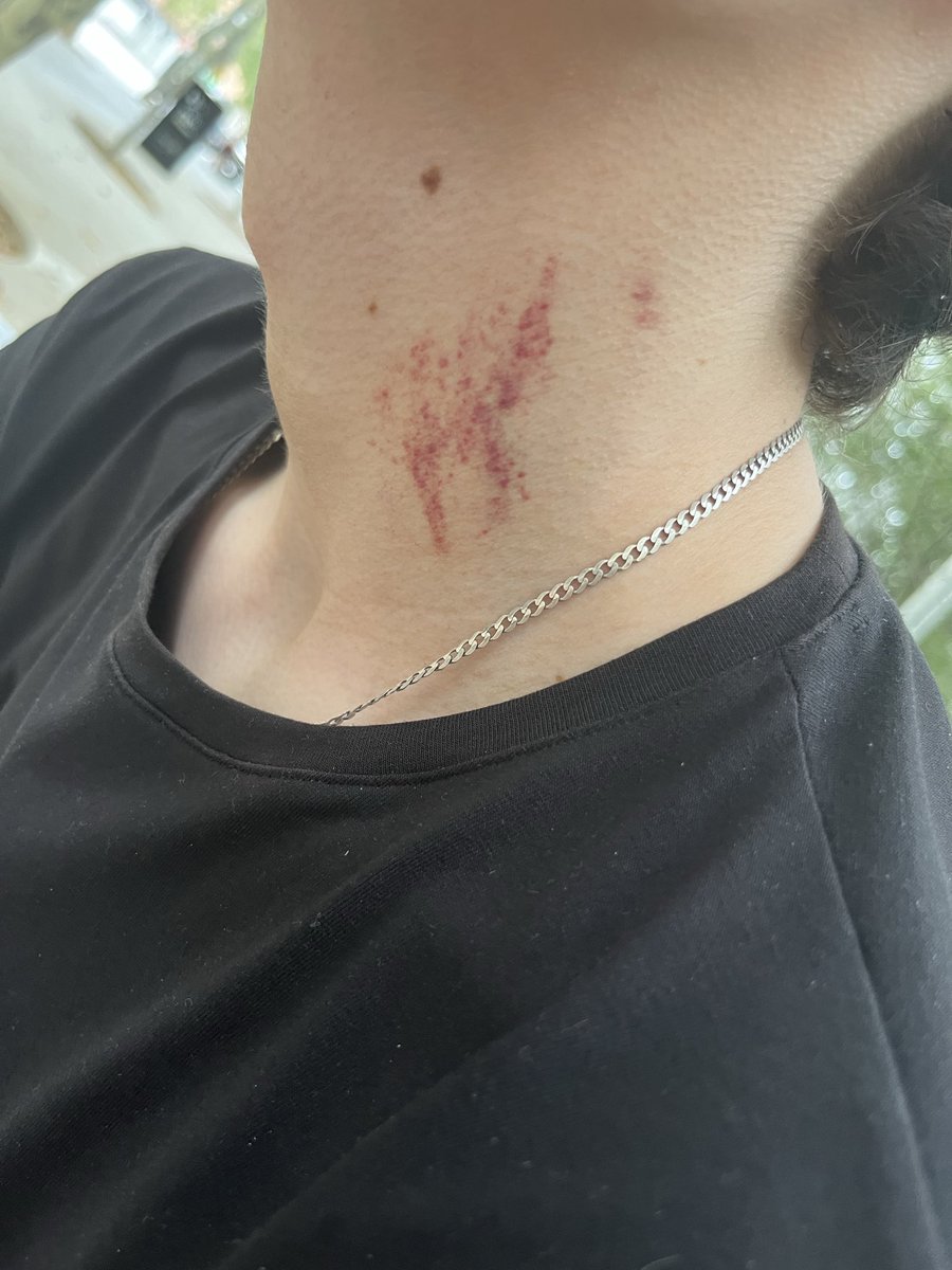stilnnoxx's tweet photo. Soy una vampira 🧛🏻‍♀️ https://t.co/Mz4DCOmsYo