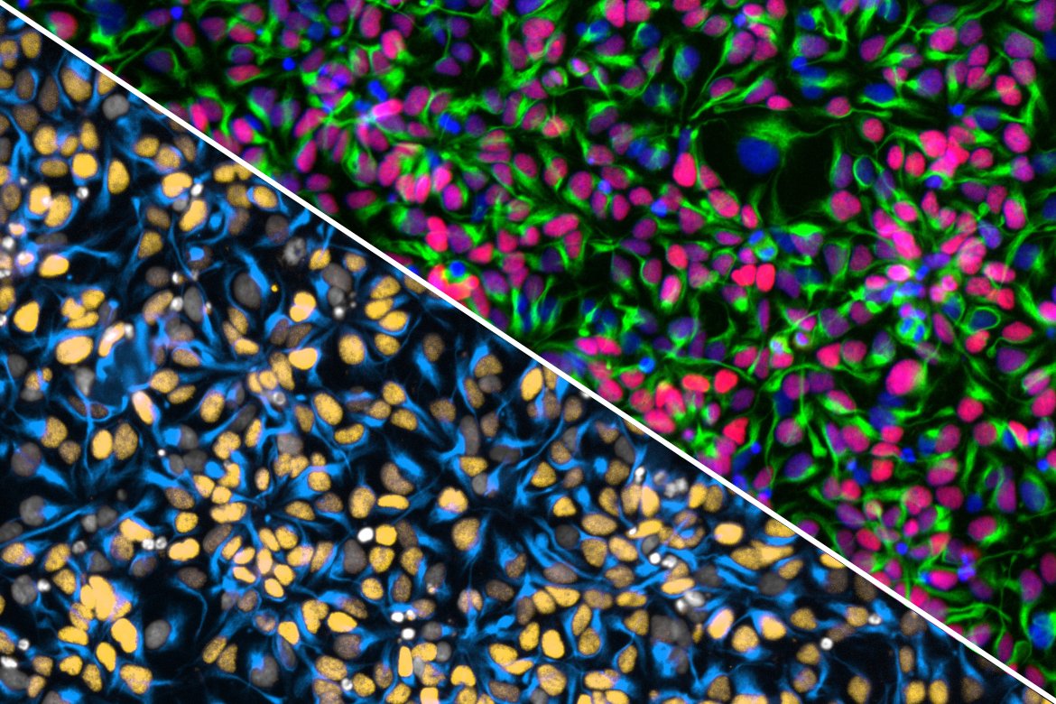 UCLAstemcell's tweet photo. UCLA scientists are building "cell villages" to uncover the genetics of brain cell fitness: how readily cells divide and how well they survive. 

🔗 https://t.co/Gb2HJeDJvY

#ResearchPowersProgress #StemCellResearch #BrainHealth https://t.co/vw4g7dSJfb