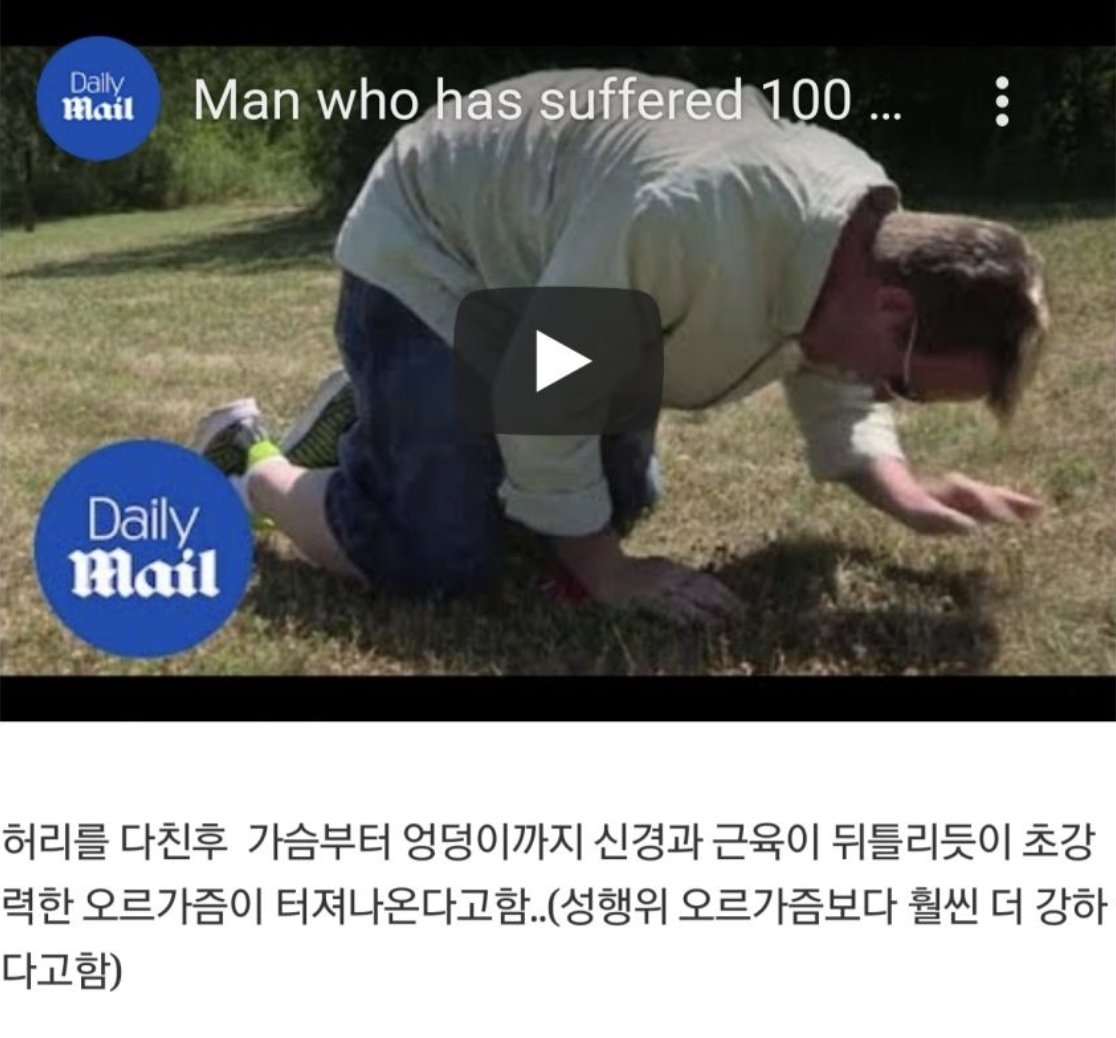 heemiiiin000's tweet photo. 하루에 100번 오르가즘 터지는 남성

- Dale Decker (당시 37세, 미국 위스콘신 주민, 두 아이의 아빠)

- 발병 계기: 디스크 탈출증 수술 후 Persistent Genital Arousal Syndrome (PGAD) 진단.

- 증상: 하루 수백 번 (최대 100번 이상) 강제 오르가즘/사정.

- 장례식장에서 아버지 관 앞에서 9번 터짐.
슈퍼마켓에서 150명 앞에서 발생 → 사람들 시선 집중.
잠자리, 운전 중, TV 보는 중에도 멈추지 않음.

- 결과: 외출 불가능, 일상생활 완전 마비. 가족(아내 April, 아들 Christian·Tayten)도 극심한 스트레스.

- 의학적 설명: 지속적 성기 흥분 증후군. 신경 손상으로 인해 통제 불가능한 성적 자극이 계속 발생.