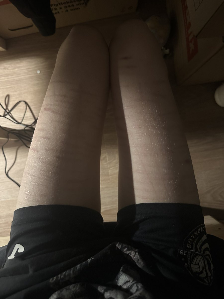 Thot123ho's tweet photo. Any bmi guesses?? https://t.co/iNEipAFtr0