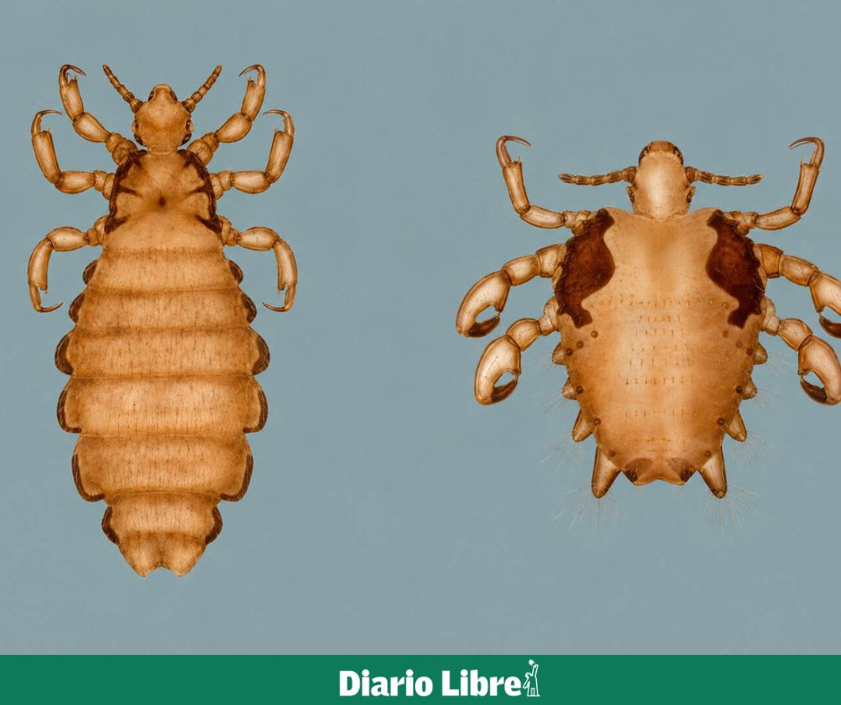DiarioLibre's tweet photo. ⚕ | #SaludDL | ¿Cuál es la diferencia entre los piojos y la ladilla?
Estos son parásitos que afectan a diferentes áreas del cuerpo y requieren tratamientos específicos
Conoce las diferencias en 🔗https://t.co/ebAUuLc53X
#DiarioLibre #Piojos #Ladilla #Salud https://t.co/5Vv089dPkR
